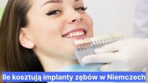 Ile kosztują implanty zębów w Niemczech